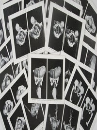 Sammlung stereoskopischer Aufnahmen als Behelf für den theoretisch-praktischen Unterricht in der Geburtshilfe (Collection of Stereoscopic Photos to Assist in Theoretical and Practical Classes in Obstetrics)