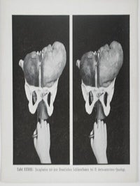 Sammlung stereoskopischer Aufnahmen als Behelf für den theoretisch-praktischen Unterricht in der Geburtshilfe (Collection of Stereoscopic Photos to Assist in Theoretical and Practical Classes in Obstetrics)