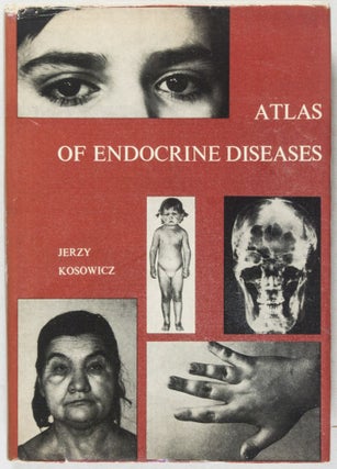 Atlas of Endoctrine Diseases