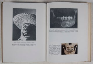 El Arte de las Mutilaciones Dentarias (Enciclopedia Mexicana de Arte 14)