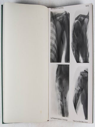 Röntgen-Atlas der Kriegsverletzungen 1914-1916: Herausgegeben von den leitenden Ärzten der Lazarettabteilungen des Allgemeinen Krankenhauses St. Georg in Hamburg