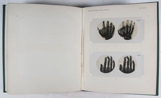 Röntgen-Atlas der Kriegsverletzungen 1914-1916: Herausgegeben von den leitenden Ärzten der Lazarettabteilungen des Allgemeinen Krankenhauses St. Georg in Hamburg