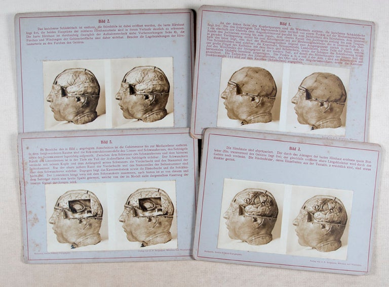 Item #46364 Stereoskopische Bilder zur Gehirn-Schädel-Topographie (Stereoscopic Images for Brain-Skull-Topography). Friedrich Heiderich.
